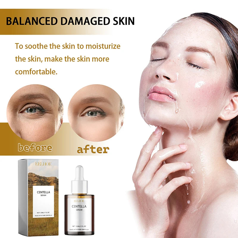 Centella Asiatica Face Serum Moisturizer Nourish Dry Skin Smoothing Rejuvenation Skin Brightening Whitening Cream Facial 2025 