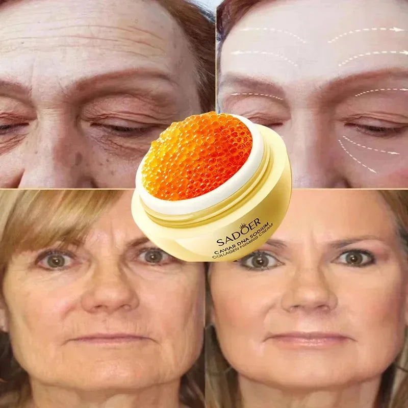 Caviar Anti-Wrinkle Face Cream Removal Facial Serum Rejuvenation Lift Firm Anti-aging Whitening Invisible Pore Beauty Skin Care