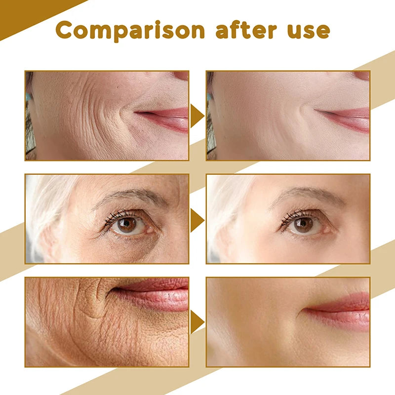 Centella Asiatica Face Serum Moisturizer Nourish Dry Skin Smoothing Rejuvenation Skin Brightening Whitening Cream Facial 2025 
