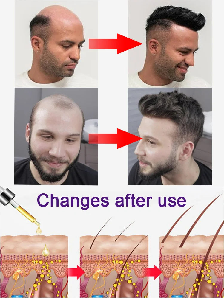 Say goodbye to baldness and have thicker hair