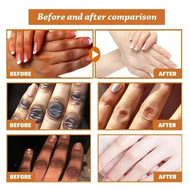 New Dark Knuckles Fast Brighten Serum Elbows Hand Knuckle Brightening Serum Knee Black Skin Spot Lighten Stains Remover Essence