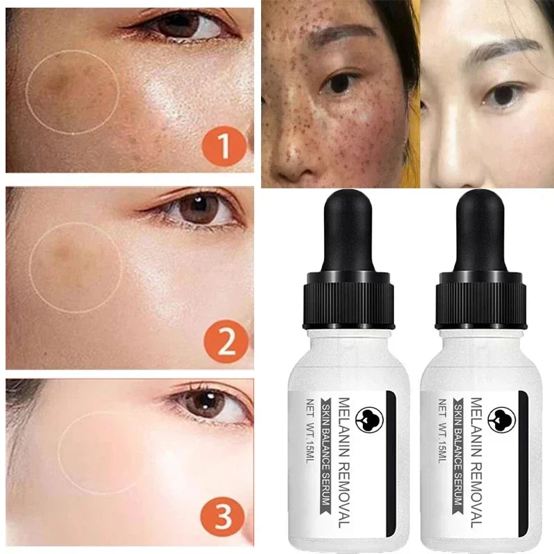 Dark Spot Remove Serum Fade Anti-aging Bright Freckle