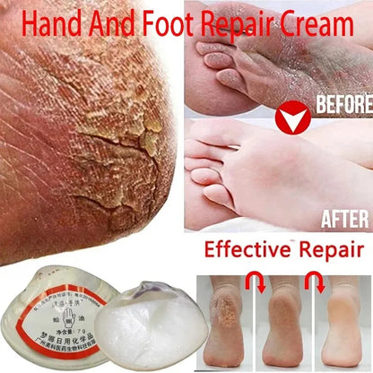 New Traditional Chinese Clam Oil Anti-Dry Crack Foot Repair Cream Removal Dead Skin Callus Soften Hand Heel Moisturize Care Mask