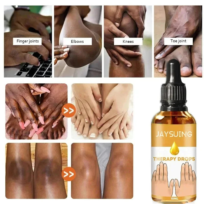 New Dark Knuckles Fast Brighten Serum Elbows Hand Knuckle Brightening Serum Knee Black Skin Spot Lighten Stains Remover Essence