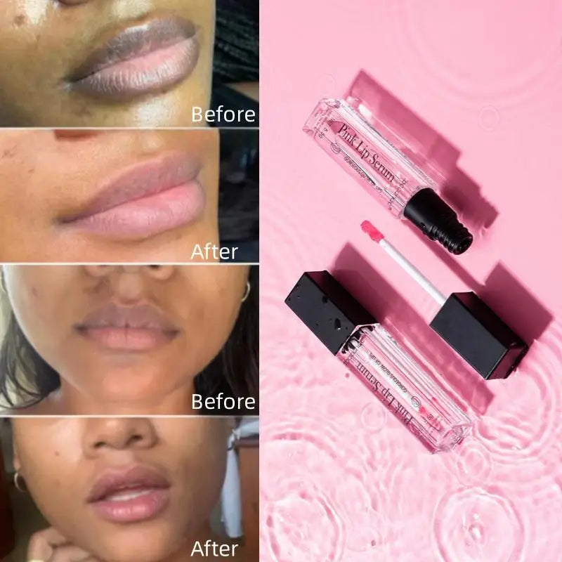 Potent Remove Darkening Lips Gloss Oil Permanently Moisturizing Exfoliating Whitening