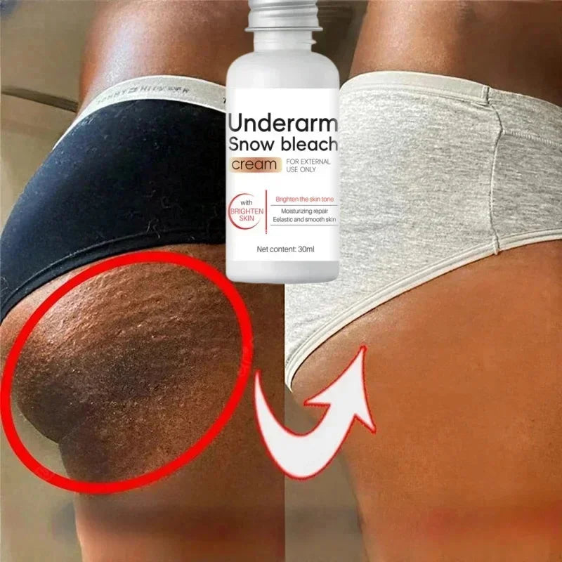 Whitening Cream Private Parts Underarm Bleaching Serum Whiten Butt Knee Brighten Inner Thigh Intimate Parts Dark Remove Melanin
