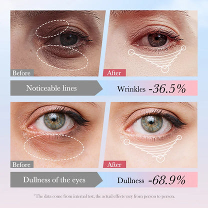 Instant Eye Bag Removal Cream Retinol Anti-Wrinkle Firming Skin Fade Fine Lines Anti Dark Circle Puffiness Brighten Eye Care