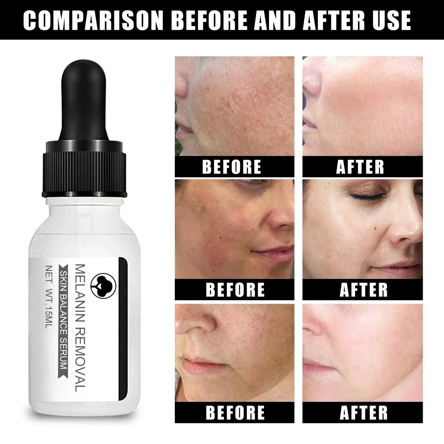 Dark Spot Remove Serum Fade Anti-aging Bright Freckle