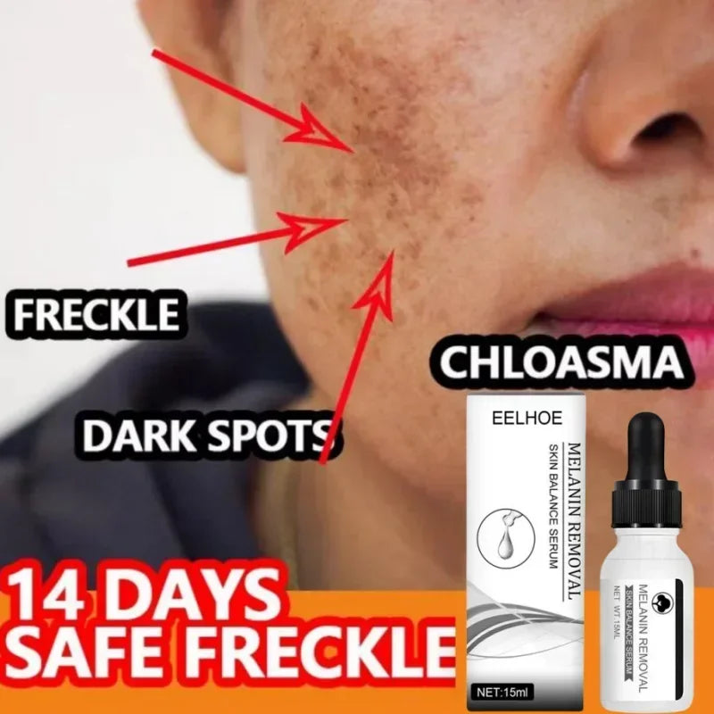 Dark Spot Remove Serum Fade Anti-aging Bright Freckle