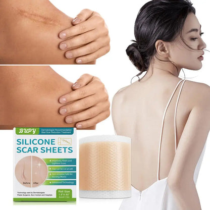 New Waterproof Surgery-Scar Removal Silicone Gel Sheet Therapy Patch Sticker Tape For Acne Trauma Burn Skin Repair-Treatment