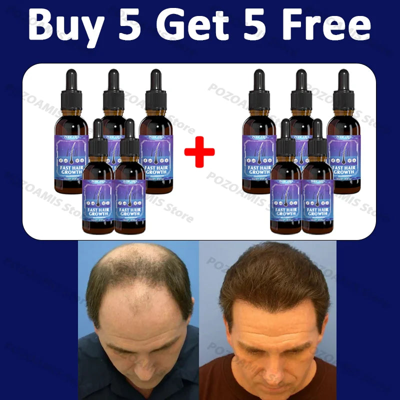 Say goodbye to baldness and have thicker hair