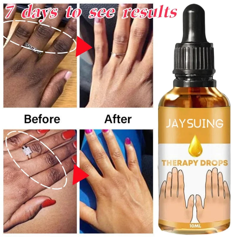 New Dark Knuckles Fast Brighten Serum Elbows Hand Knuckle Brightening Serum Knee Black Skin Spot Lighten Stains Remover Essence