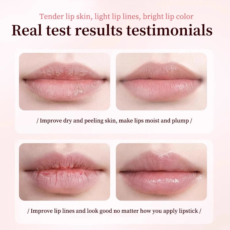 Lip Balm Remove Dark Spots Pigment Fast Lighten Pink Lips Cream Hyaluronic acid lips Exfoliate Dead Skin Whiten Moisturizer Care