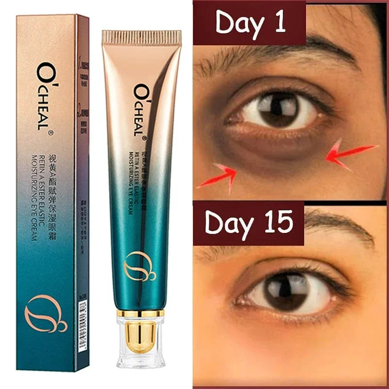 Instant Eye Bag Removal Cream retinol Anti-Wrinkle Fade Fine Lines Firming Skin Anti Dark Circle Puffiness Brighten Eye Care New