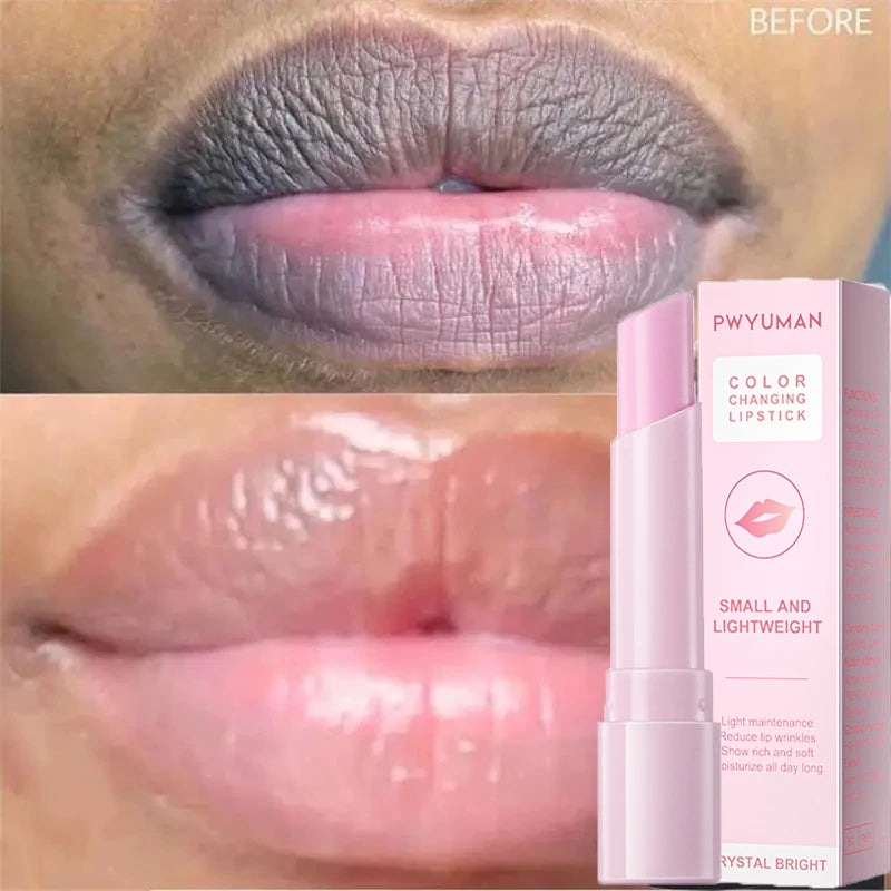 Lip Balm Remove Dark Spots Pigment Fast Lighten Pink Lips Cream Hyaluronic acid lips Exfoliate Dead Skin Whiten Moisturizer Care