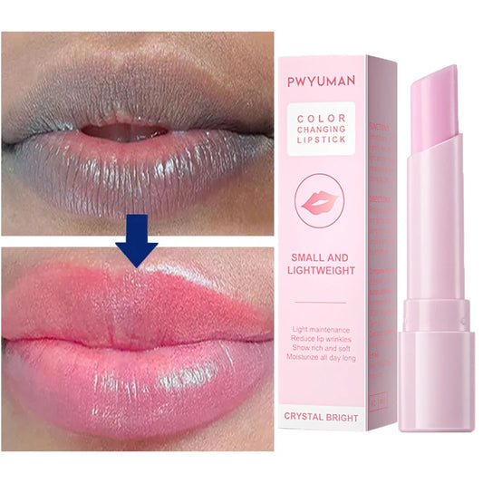 Lip Balm Remove Dark Spots Pigment Fast Lighten Pink Lips Cream Hyaluronic acid lips Exfoliate Dead Skin Whiten Moisturizer Care