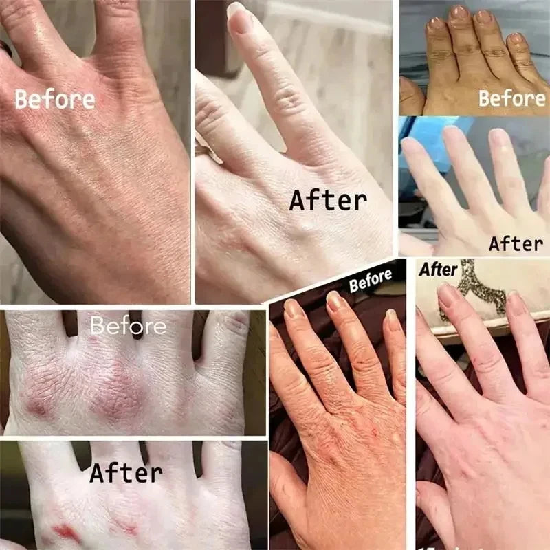 Kojic Acid Whiten Hand Cream,Moisturizing Nourishing Niacinamide Hyaluronic Acid Tender Hand Lotion,Foot Skin Care Products