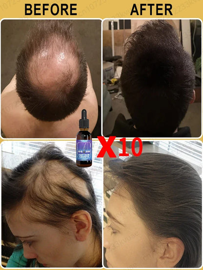 Say goodbye to baldness and have thicker hair