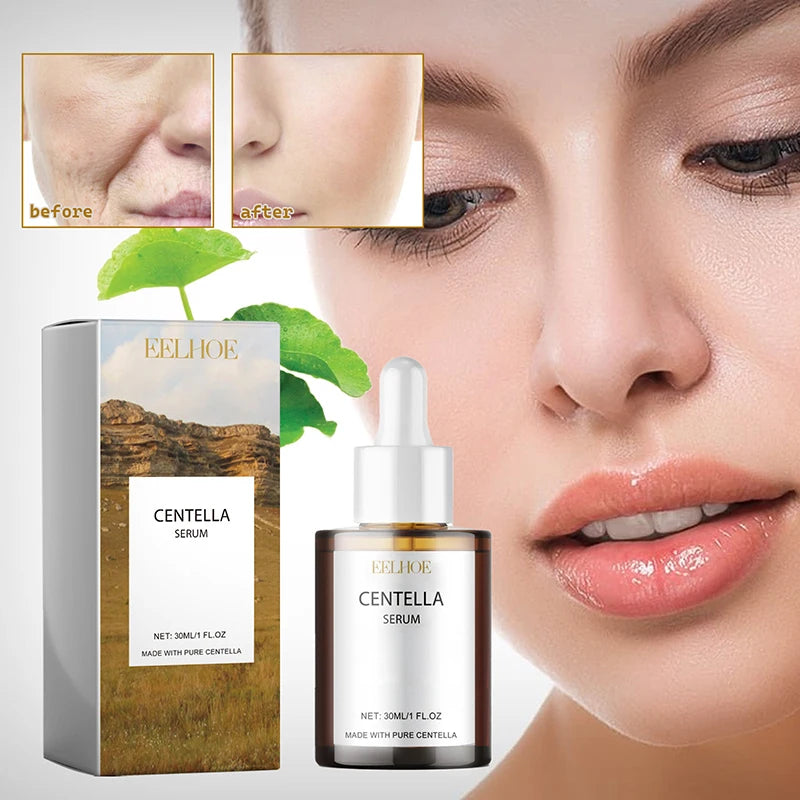 Centella Asiatica Face Serum Moisturizer Nourish Dry Skin Smoothing Rejuvenation Skin Brightening Whitening Cream Facial 2025 ﻿