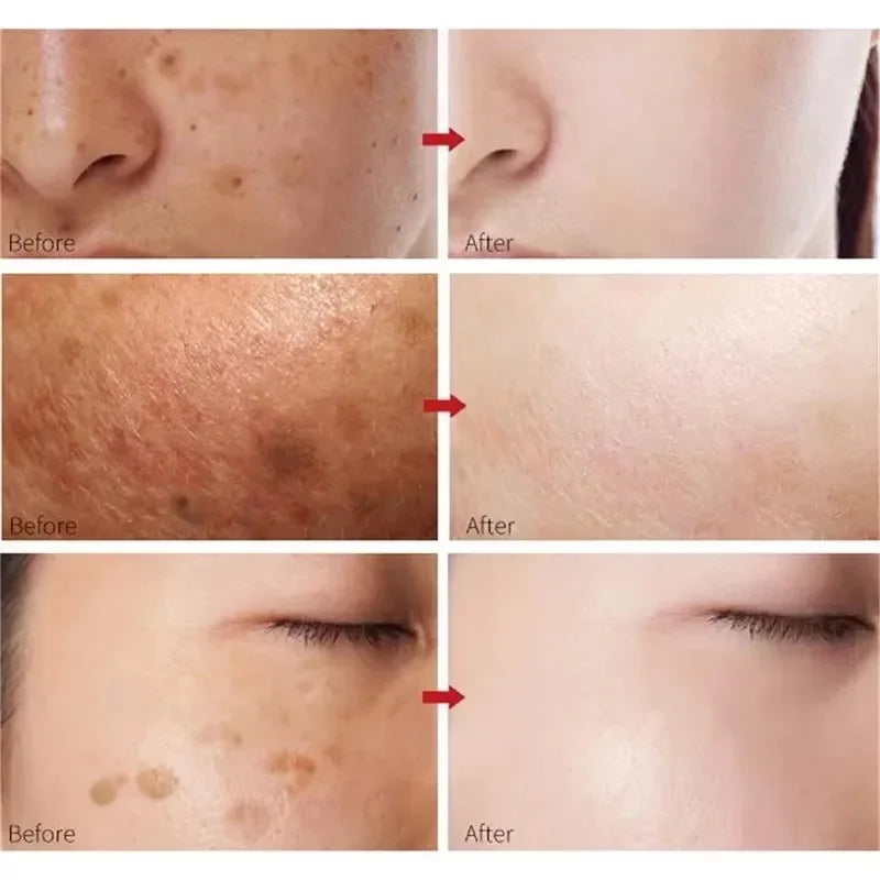 30ml Peach 70% Niacinamide Serum Moisturizing Prevent Dryness Facial Essential Oil Increasing Elasticity Smooth Soften Skin Care