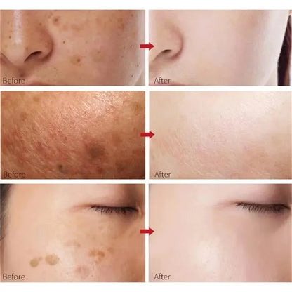 30ml Peach 70% Niacinamide Serum Moisturizing Prevent Dryness Facial Essential Oil Increasing Elasticity Smooth Soften Skin Care