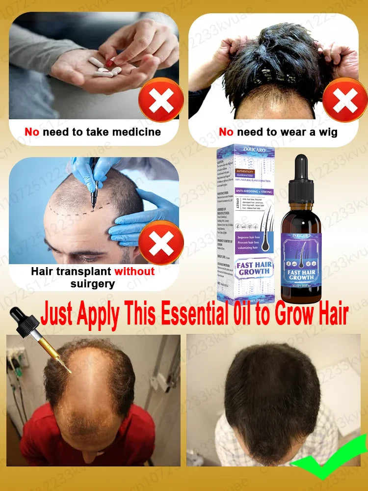 Say goodbye to baldness and have thicker hair