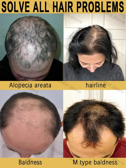 Say goodbye to baldness and have thicker hair