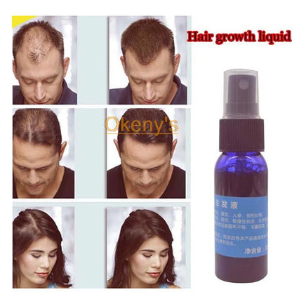 Ginger Hair Growth Essence Yuda Pilatory Stop Hair Loss Fast Hair Growth Products for Men and Woman  Grow Restoration 30ml