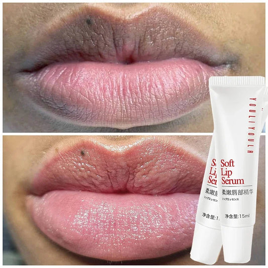 Lip Pink Fresh Lightening Bleaching Cream Treatment Remove Dark Smoke Lips Lip Balm Whitening Moisturizer Nourishing Essence