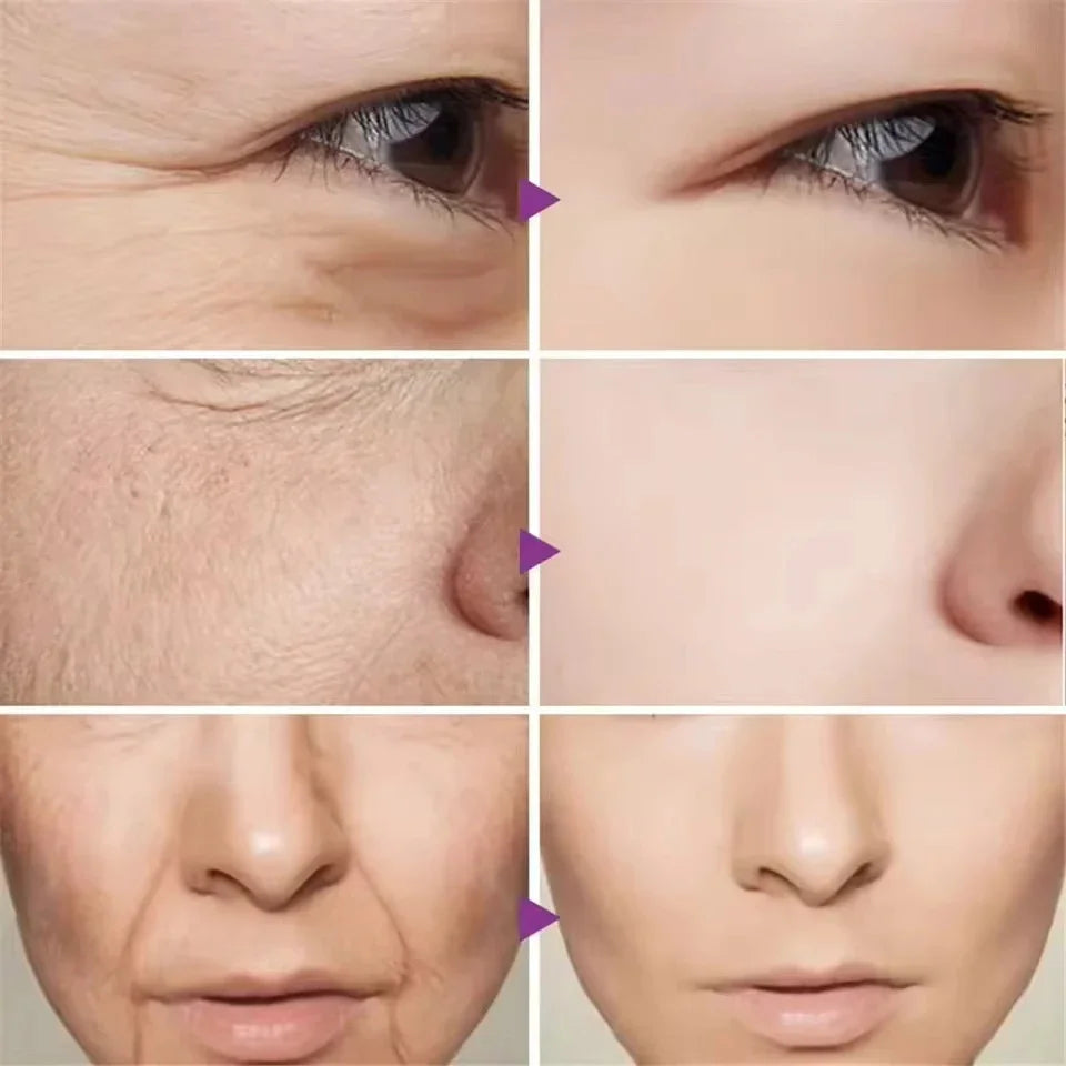 Caviar Anti-Wrinkle Face Cream Removal Facial Serum Rejuvenation Lift Firm Anti-aging Whitening Invisible Pore Beauty Skin Care