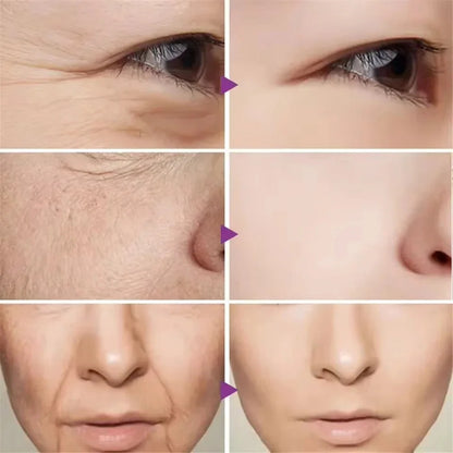 Caviar Anti-Wrinkle Face Cream Removal Facial Serum Rejuvenation Lift Firm Anti-aging Whitening Invisible Pore Beauty Skin Care