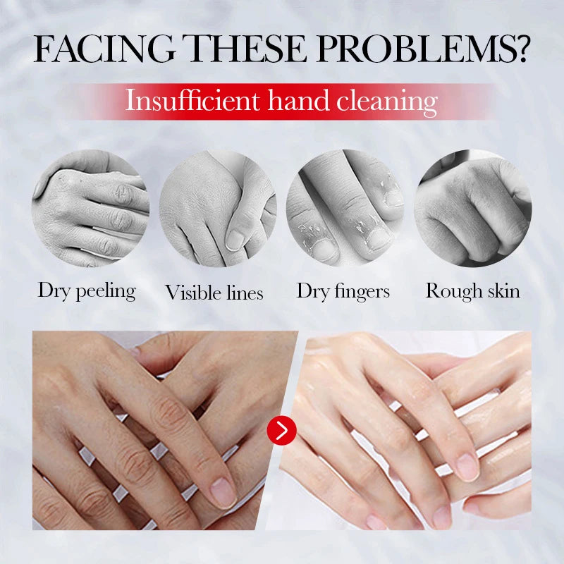 Kojic Acid Whiten Hand Cream,Moisturizing Nourishing Niacinamide Hyaluronic Acid Tender Hand Lotion,Foot Skin Care Products