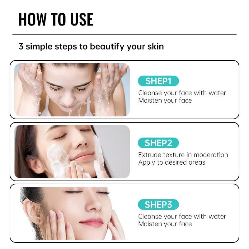 Acne Treatment Face Cream Repair Pimple Spots Deep Cleaning Oil