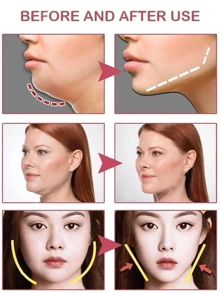 Slimming Cream Removal Masseter Muscle Double Chin Face Fat Burning