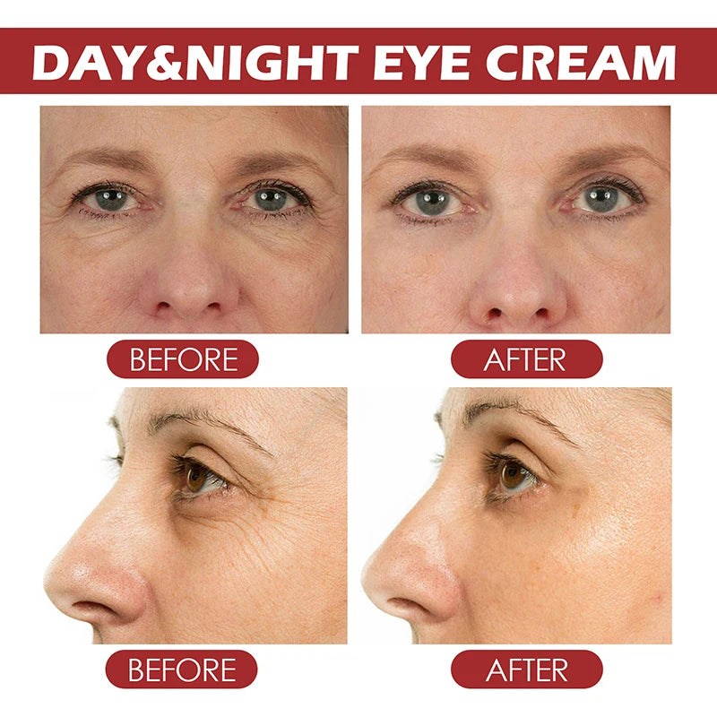 Instant Eye Bag Remove Eye Cream Lift Brighten Korean Eye Care New