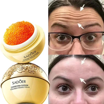 Caviar Anti-Wrinkle Face Cream Removal Facial Serum Rejuvenation Lift Firm Anti-aging Whitening Invisible Pore Beauty Skin Care